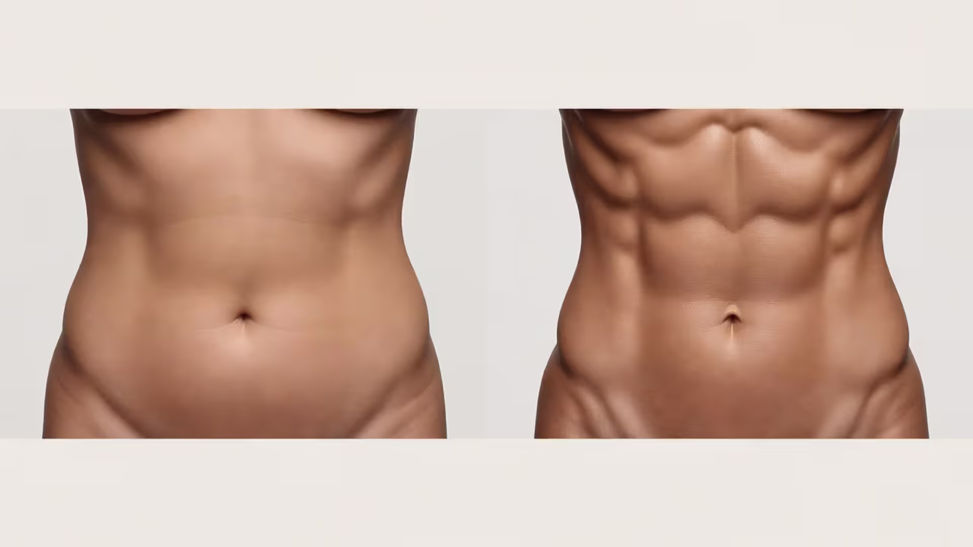 How Much Weight Can You Lose with Liposuction